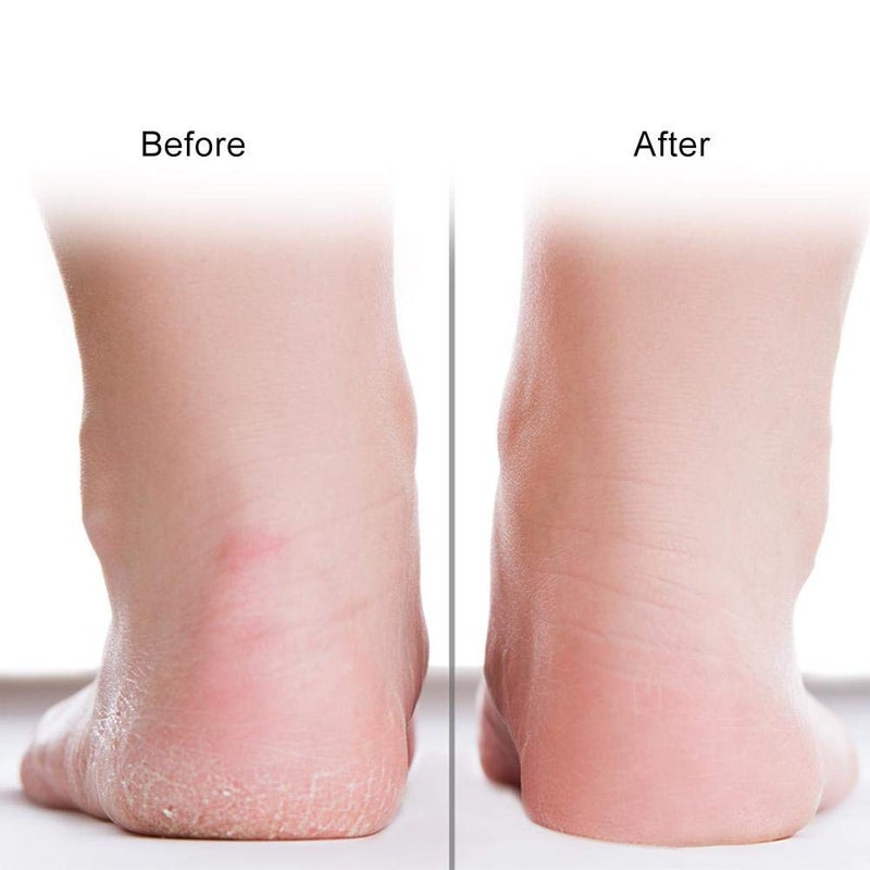 woobles Silicone Sock, 1pair Crack-Proof Moisturizing Socks Protector Foot Care Tool Prevention Socks for Women with Breathable Hole for Dry Cracked Heel(L-02#) - Image 3
